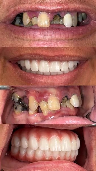 OneSolution Dental Implant Centers - Orlando