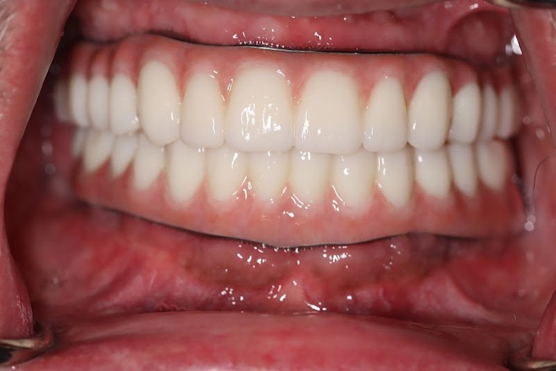Ora Dental Implant Studio