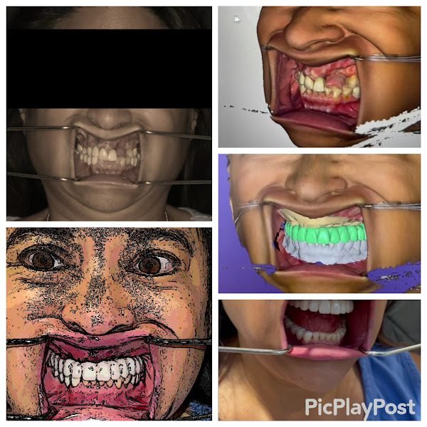 Ora Dental Implant Studio 2