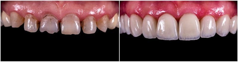 Perfect Smile Dental Centers - Bird Road