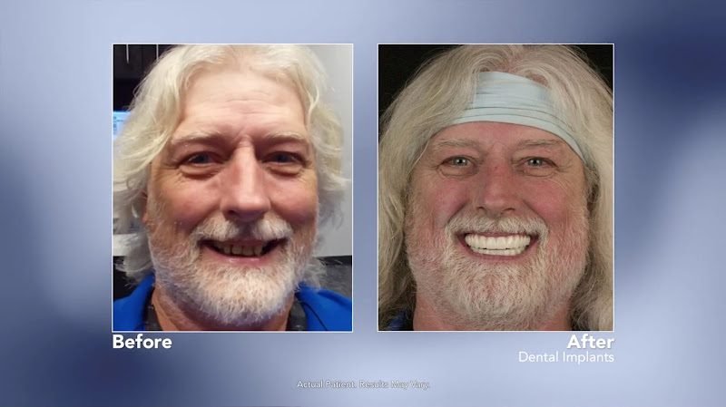 Smile Now Colorado Springs Dentures and Implants