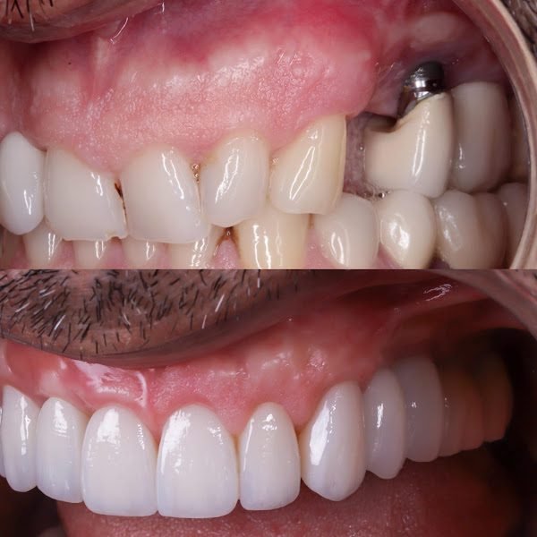 Super Dentist Miami