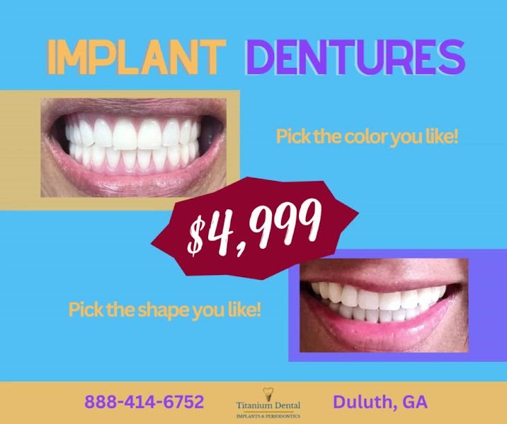 TITANIUM DENTAL 2