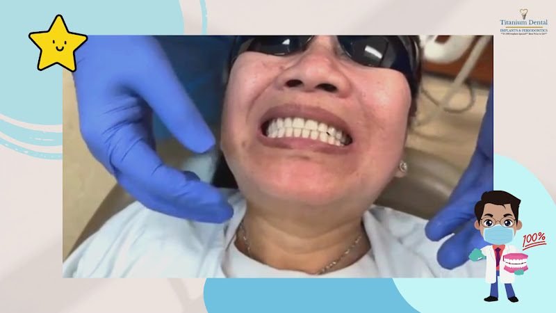 TITANIUM DENTAL