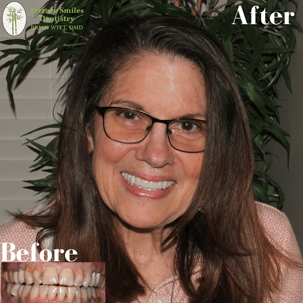 Tampa Dentist - Terrace Smiles Dentistry