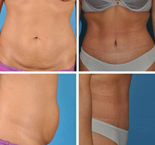 Totonchi Plastic Surgery 2