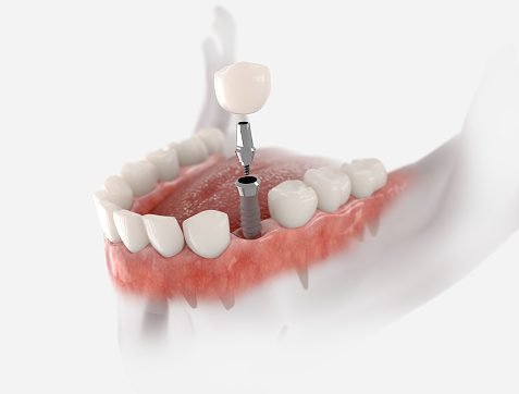 Urgent Dental