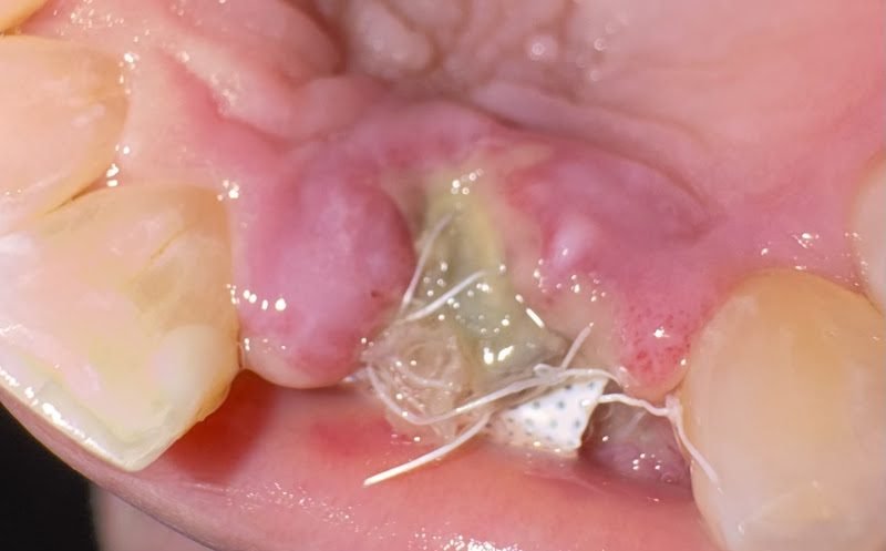 Westshore Periodontics and Dental Implants - North Olmsted 2