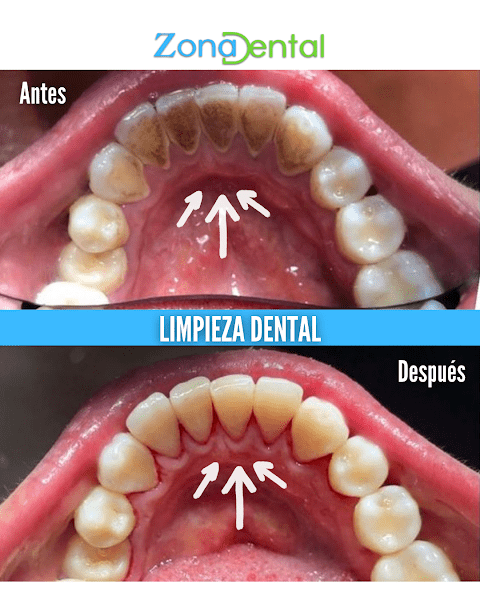 Zona Dental Atlanta
