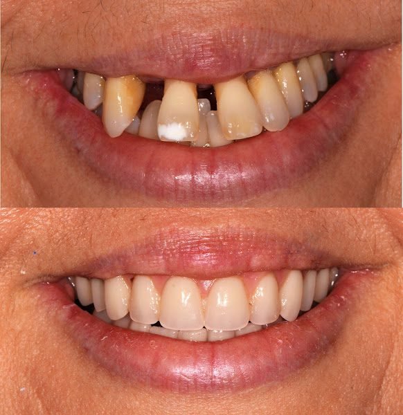 Cosmetic Dentist Honolulu : Wynn H. Okuda DMD Inc 4