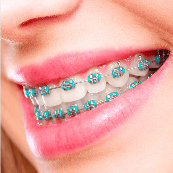 Cyterski Orthodontics DMD