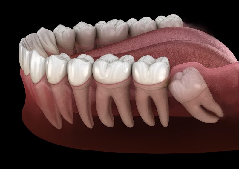 Layton Ridge Oral Surgery