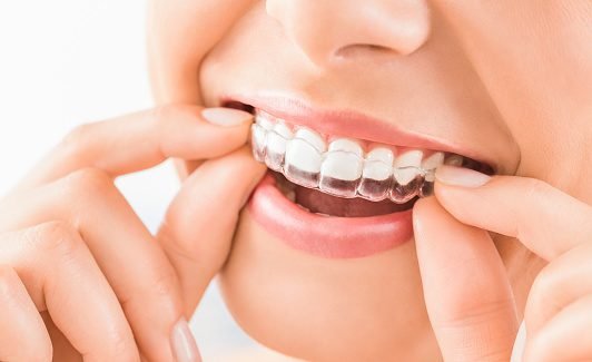 Nelson R. Diers, DDS, MSD - Fairfield