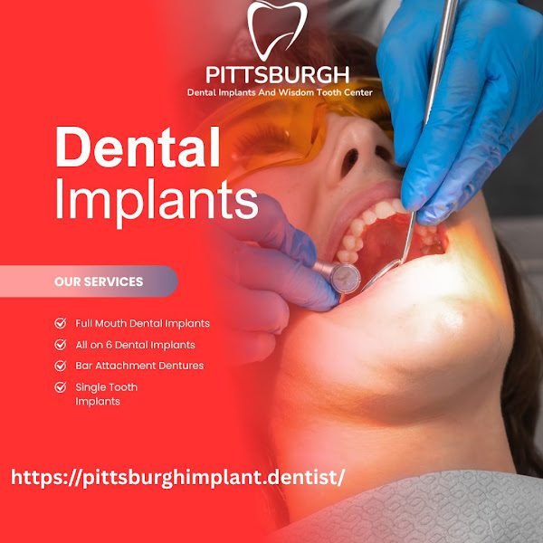 Pittsburgh Implant Dentist