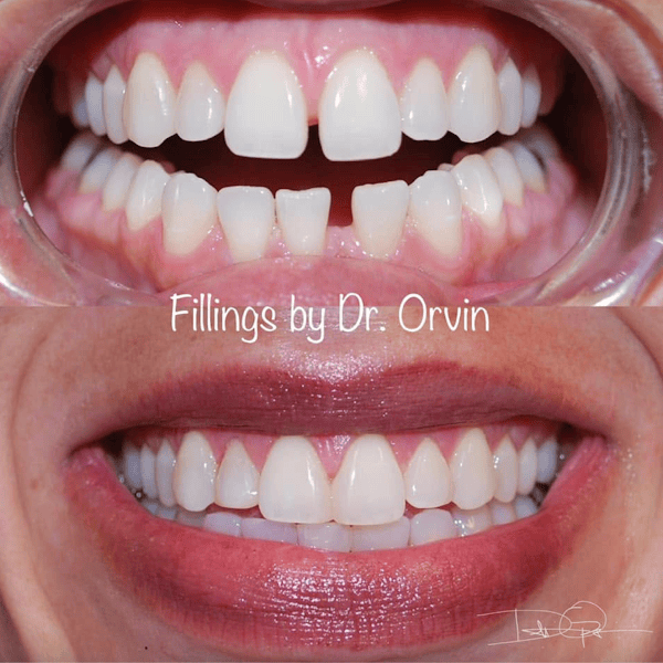 The Tooth Doctor - Cottonwood Heights