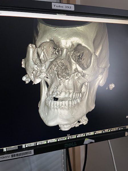 Utah Oral Surgery & Dental Implant Center