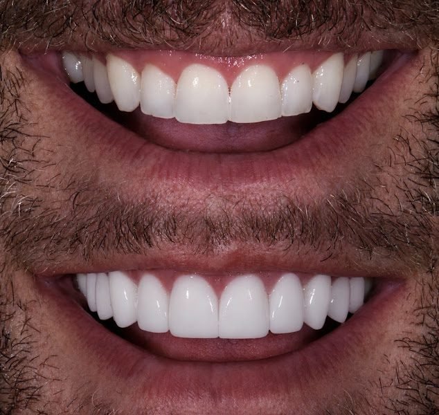 Chandler Dentistry