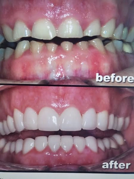Grace Family Dental