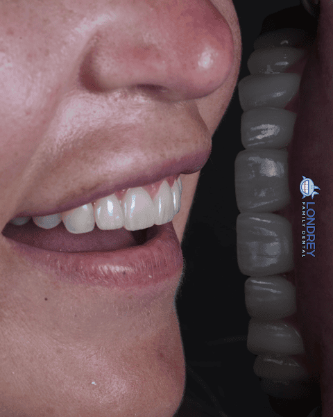 Londrey Family Dental
