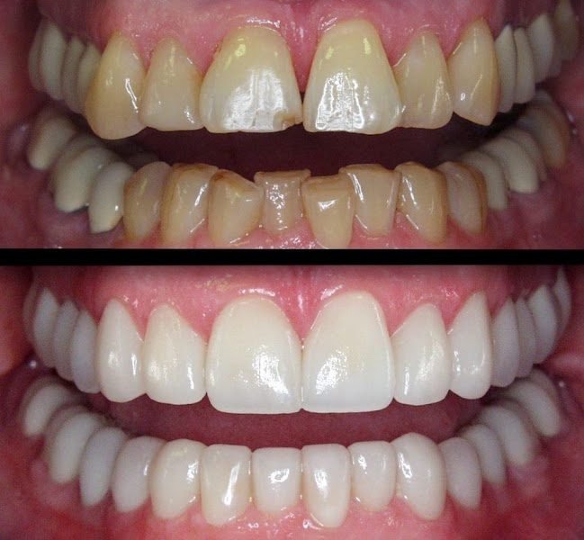 Smile Concepts AZ