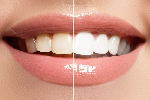 South River Dentistry
