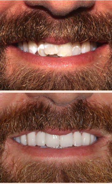 StoneCreek Dental Care - Birmingham Montclair