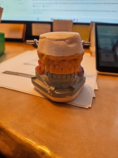 The Denture Company : Boise Dentures 3
