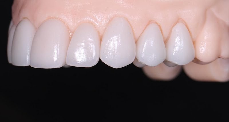Almont Dental