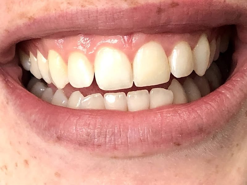 Caring Family Dentistry Irvine