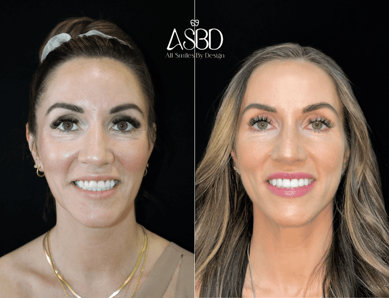 Dentist Henderson - All Smiles By Design