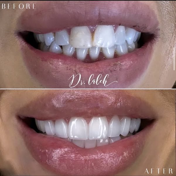 Doctor Laleh Dental Aesthetics- Dr. Laleh Mehrrafiee DDS 2
