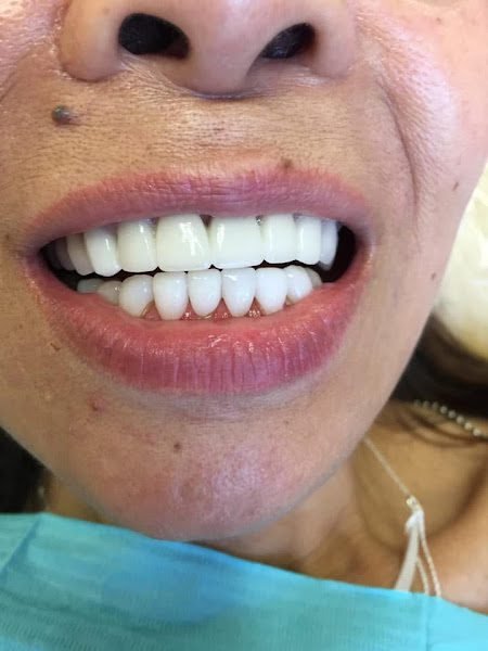 Dr. Amir Family , Cosmetic and implant dental