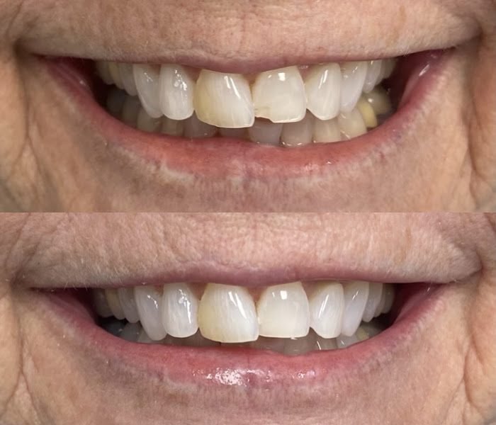 Green Valley Dental Center 2