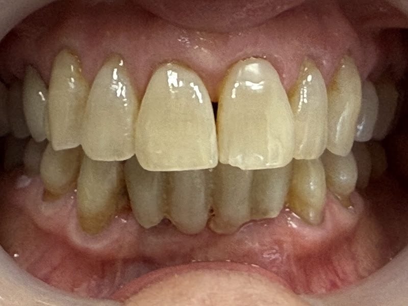 Irvine Family & Implant Dentistry 2