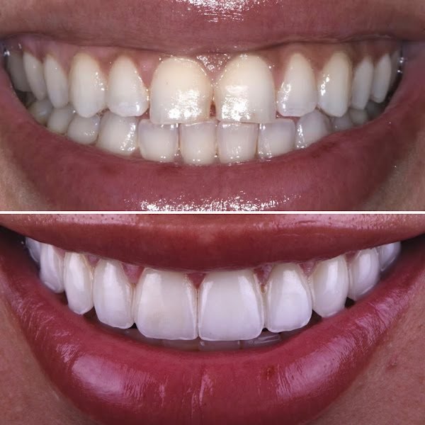 Las Vegas Aesthetic Dentistry