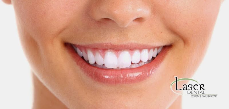 Laser Dental