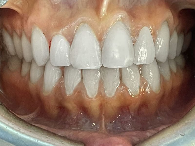 Media Najafi, DDS 2