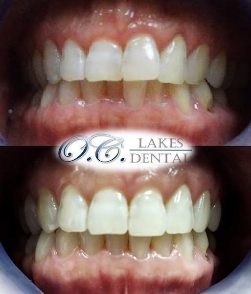 OC Lakes Dental 2